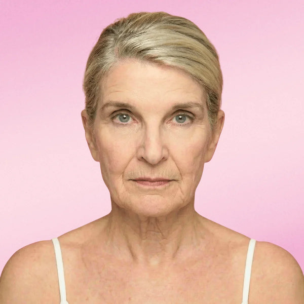 Tersa Lift™ | Cara