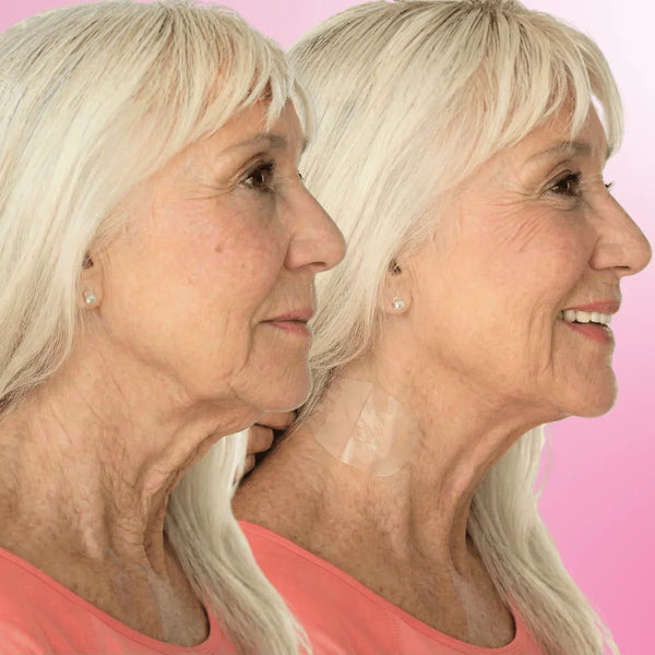 Tersa Lift™ | Cuello & Papada