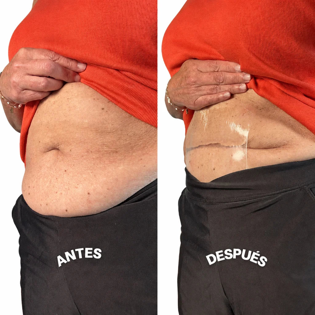 Antes y después panza